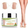ELAIMEI Varicose Veins Cream Relief Phlebitis Angiitis Inflammation Blood Vein