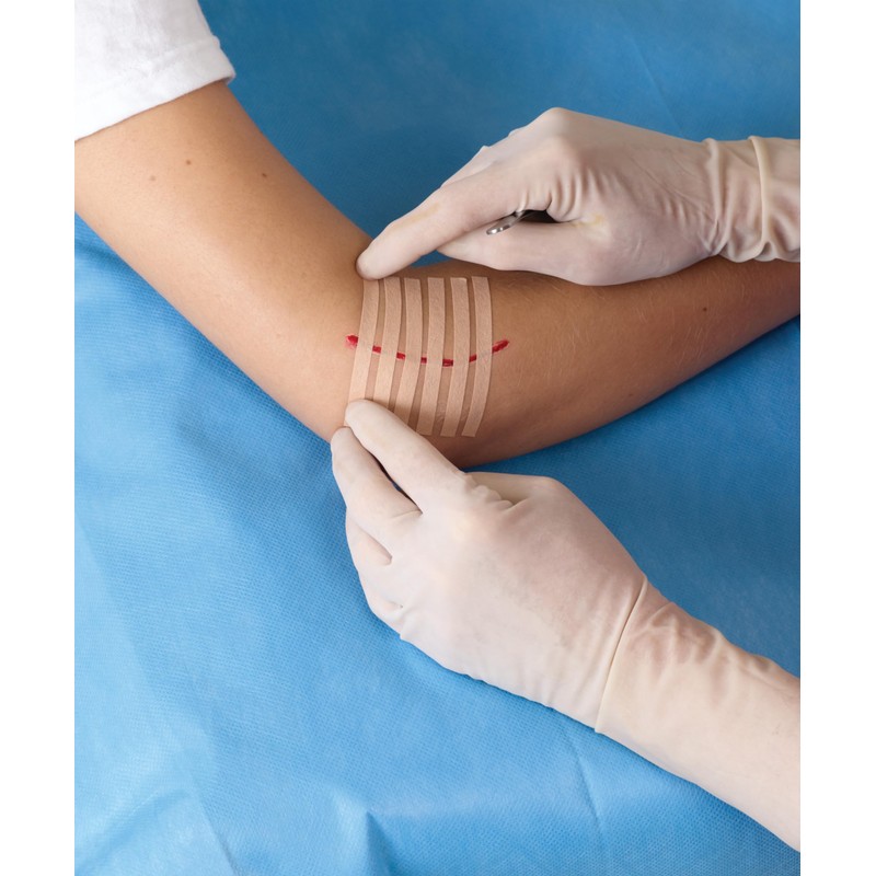 Nexcare Steri-Strip Skin Closures, Tan, 6 mm x 75 mm,