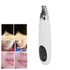 Rechargeable Red Light Laser Picosecond Pen Handheld Spot Mole Acne