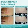 Silicone Scar Sheets, Silicone Scar Tape(1.6"x 158"), Scar Tape for