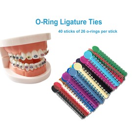40 Stripes Orthodontic Ligature Ties(1040 pcs) Braces Rubber Bands O-Ring for Brace, Random Color