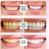 2PCS Sp-6 Ultra Whitening Toothpaste,SP-6 Toothpaste,SP6 Probiotic Toothpaste,SP-6 Probiotic Whitening