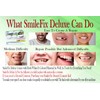 SmileFix Deluxe Dental Repair Kit - Color Matching Compound -