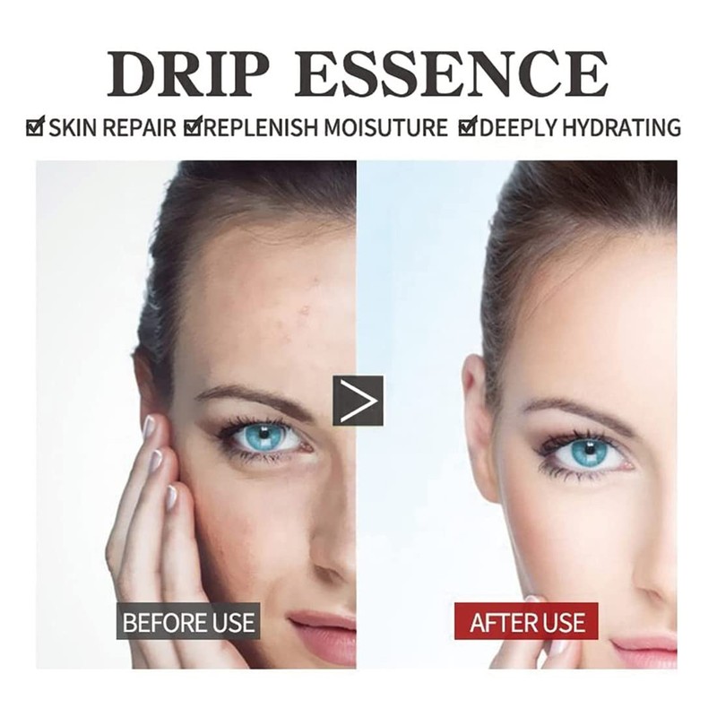 Eelhoe Eternity Vitamin C Serum Dark Spot Corrector, Esencia de