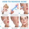 100PCS Disposable Acne Needle & 144 Dots Pimple Stickers -