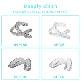 Ultrasonic Retainer Cleaner Machine for Denture, Jewelry, Nightguard, Portable Ultrasonic Jewelry Cleaner for Professional Cleaning at Home or Travel Use(White)