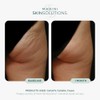 CelluliTX by Marini SkinSolutions for Unisex - 4 oz Cream