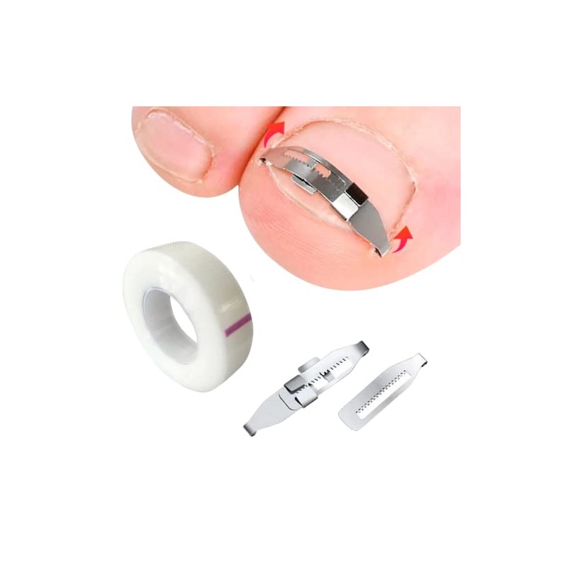 Universoenlnea.com Pack 32 Parches Corrector de Uas y Herramienta Correctora