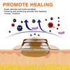 Carbou Wound Dressing Sacrum Silicone Foam Dressing, 6''x7''(15cm x18cm) Bordered