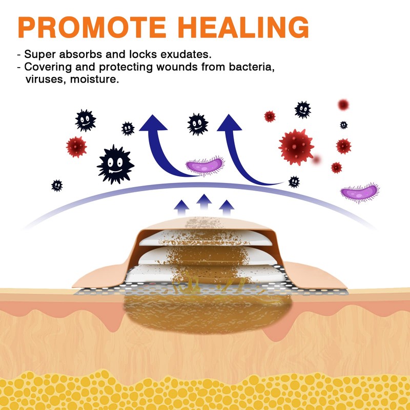 Carbou Wound Dressing Sacrum Silicone Foam Dressing, 6''x7''(15cm x18cm) Bordered