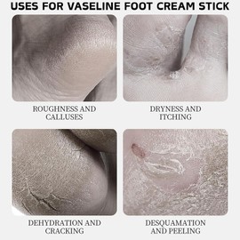 2PCS Vaseline Foot Cream Stick, Foot Repair Cream for Cracked Heels and Dry Skin, Vaseline Intensive Care Deep Moisturiser Stick, Foot Balm for Calluses and Severe Dry Feet,Softens Exfoliates,Portable