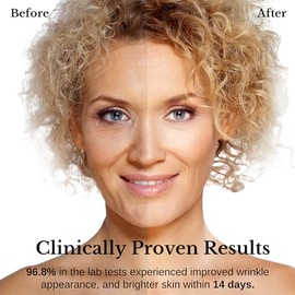 Lamelin Crema de Suero Antiarrugas  Retinol Bakuchiol Niacinamide Anti-Wrinkle Serum, 50ml                                                            