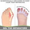 Toe Spacers(2 Pair), Gel Toe Separators to Correct Toes, Bunion