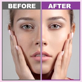 Skin Care Set,6 Pcs Anti-aging Skincare w/Korean Retinol,Hydrate, Moisturize Self Care Facial Skin Care Routine Kit Women Teen Girls Travel Skincare G