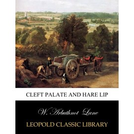 Cleft palate and hare lip