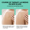 Large Silicone Scar Sheets 4 Pcs - 6" x 5"