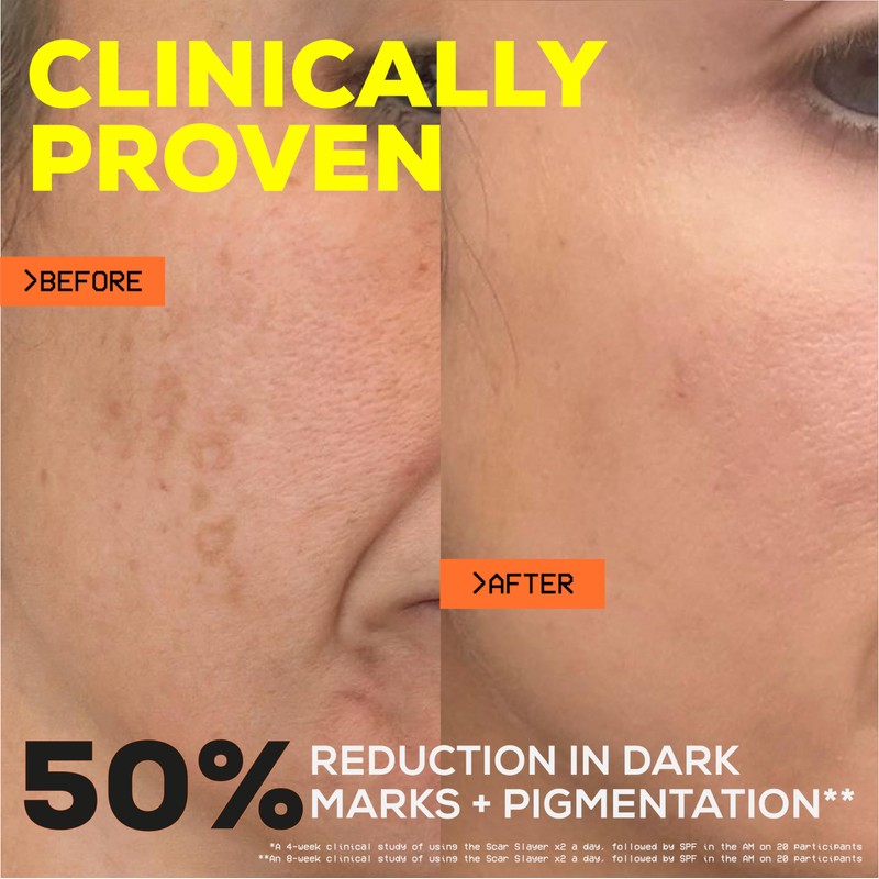 Glow Hub The Scar Slayer Facial Serum with Vitamin C