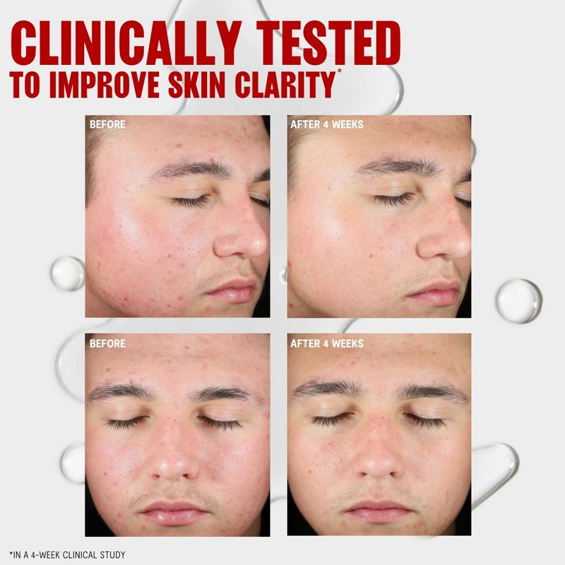 Thayers Blemish Clearing Salicylic Acid Toner, Acne Treatment Face Toner