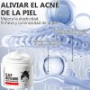 Crema De Ácido Kójico De 2 Piezas: Blanquea Las Pecas