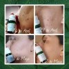 Tonico/sérum/jabón Tea Tree/control Acné/grasa/farmasi