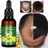 Ginger Germinal Hair Growth Serum: 7-Day Regrowth Hairdressing Oil for Treatment of Hair Loss
