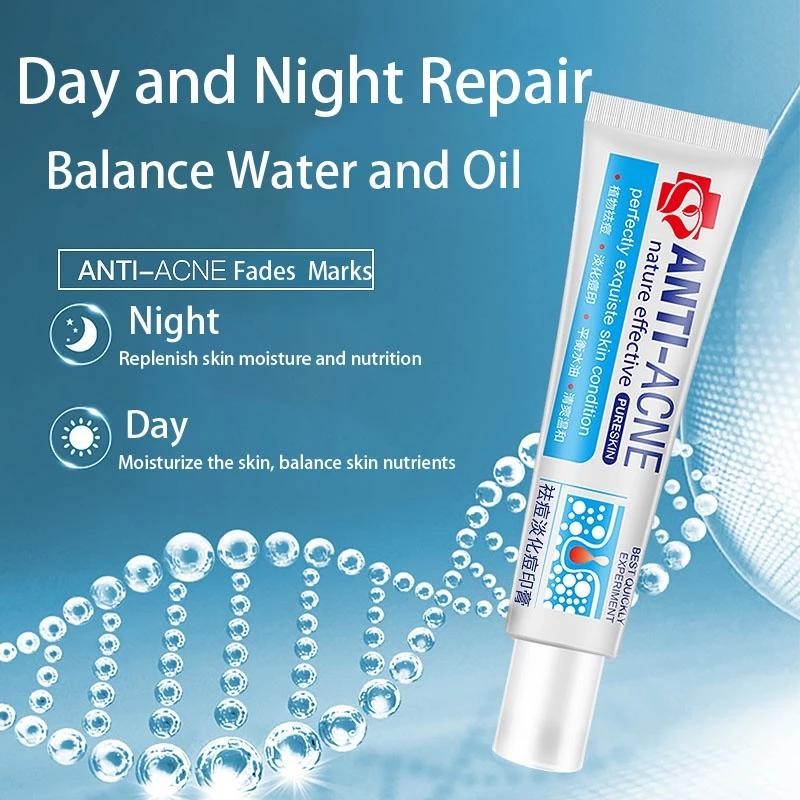 No Brand Real and effective Acne Pimple Cream 祛痘膏祛痘乳霜 20g