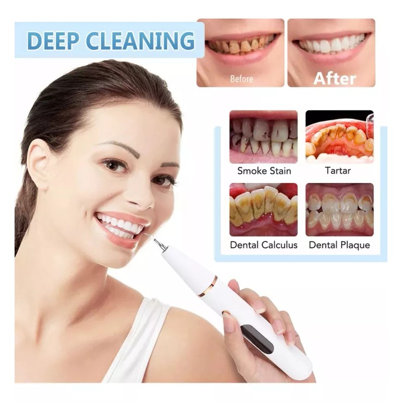 Hikvison Limpiador Dental Eléctrico Para Blanqueamiento Dental