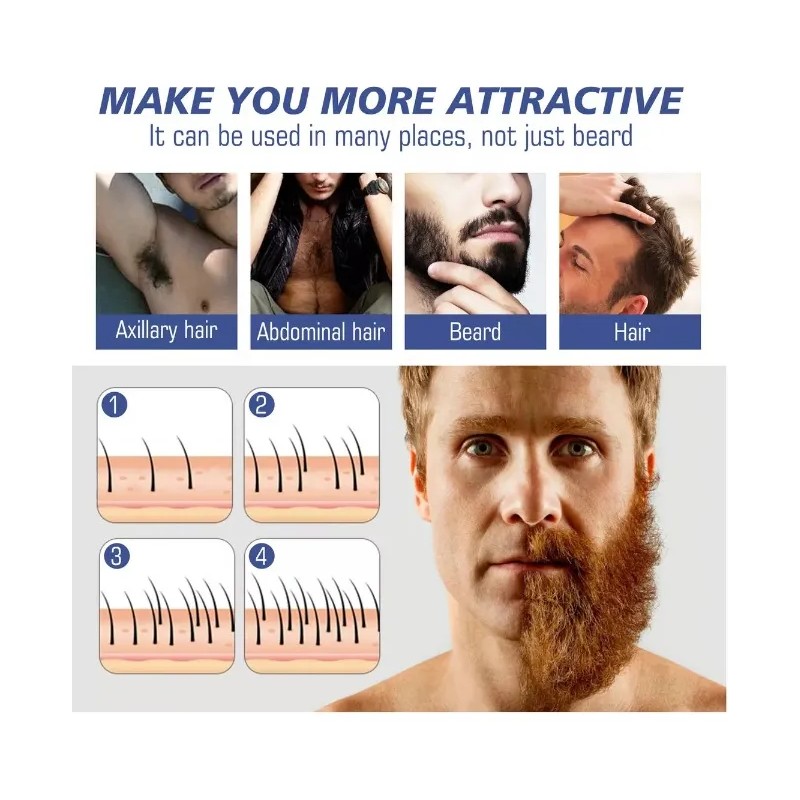 Barba Bigote Bello Sano Aceite Anticaspa Crecimiento Fuerte Argán