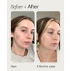 faded Topicals Mini Brightening & Clearing Serum - Tranexamic Acid