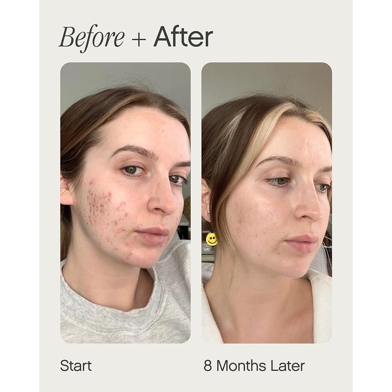 faded Topicals Mini Brightening & Clearing Serum - Tranexamic Acid