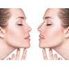 3D Rhinoplasty Respingadores Nasales 7 Pzs Corrector Invisible Estiliza