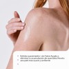 Crema humectante para queratosis pilaris KP Bumps Be Gone de