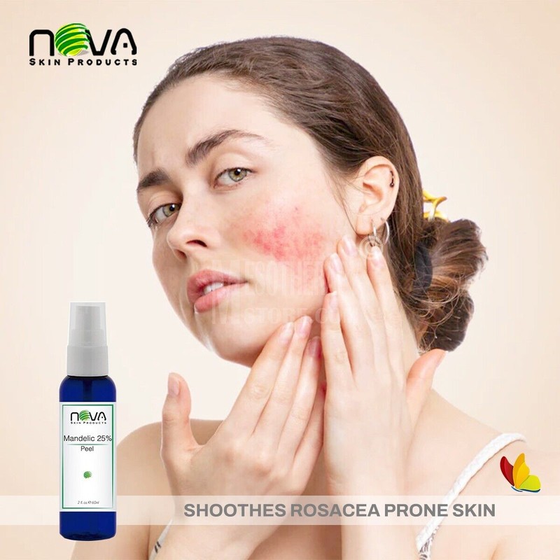 NOVA SKIN Mandelic Acid 25% Peel By Nova Skin