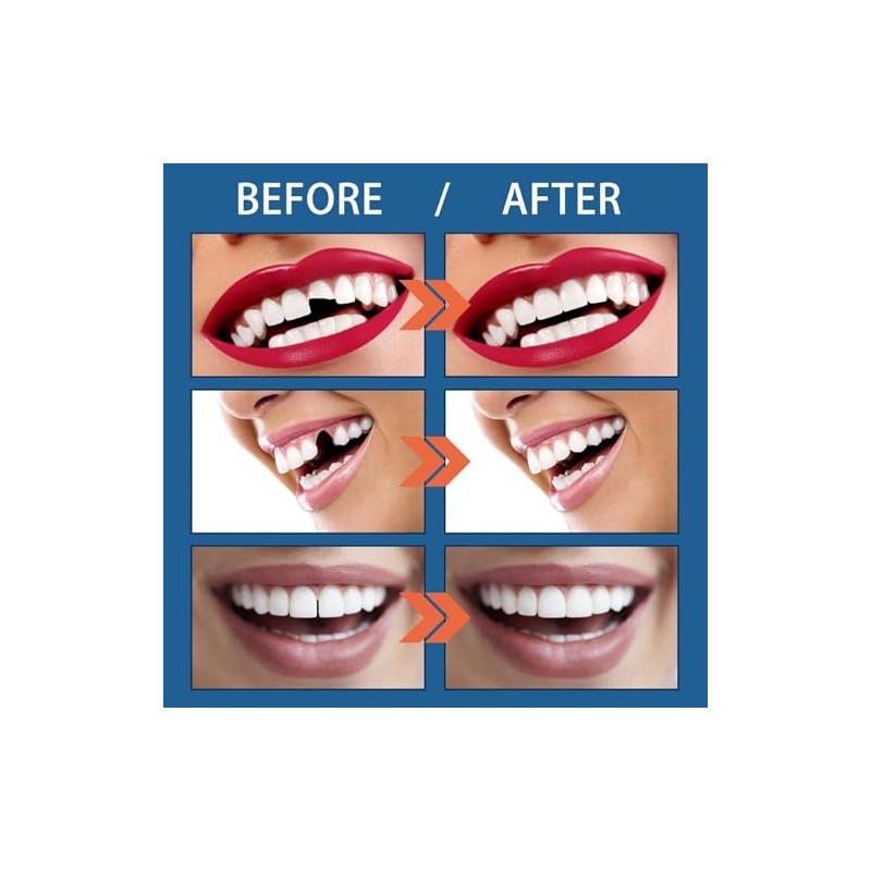 Teeth Dientes Postizos Dientes Falsos