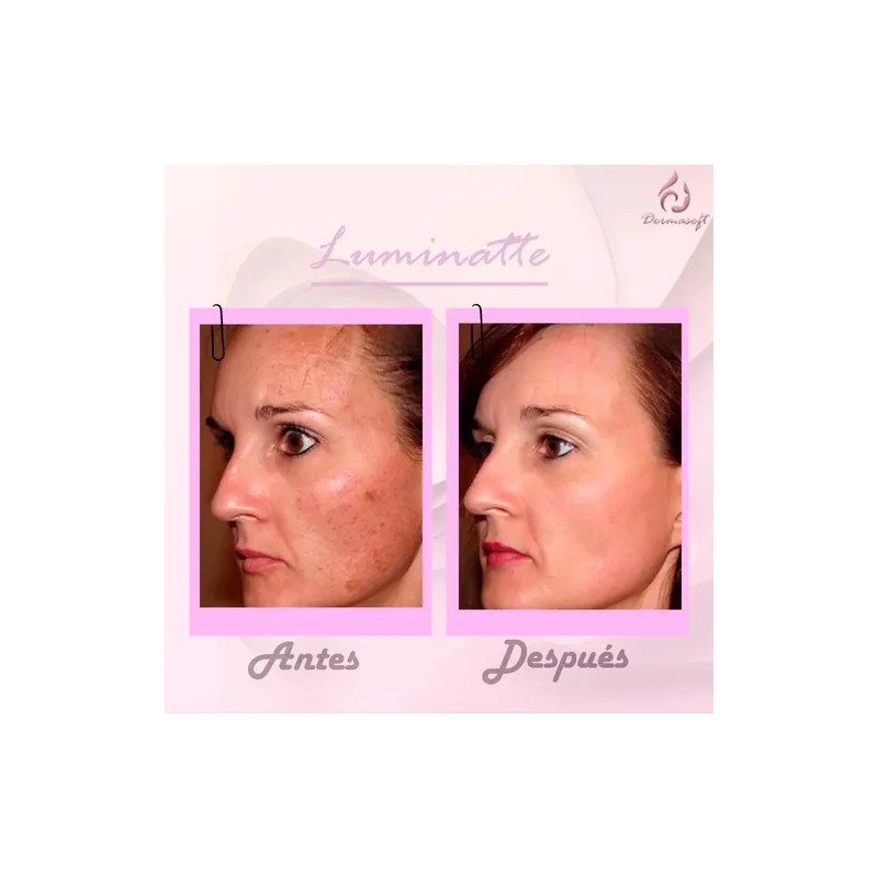 4pack Crema Facial & Corporal Luminatte Aclaradora, Melasma.