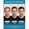 Biotin Rosemary Hair Growth Men Shampoo for Hair Loss 8