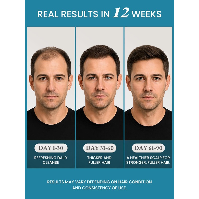 Biotin Rosemary Hair Growth Men Shampoo for Hair Loss 8