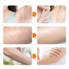 Electric Hair Removal Epilator Rechargeable Detachable Head for Women Man