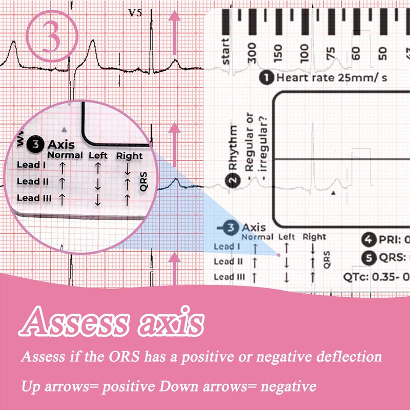Ecg 7 Step Ruler, Ecg/Ekg 7 Step Ruler Card, Portable
