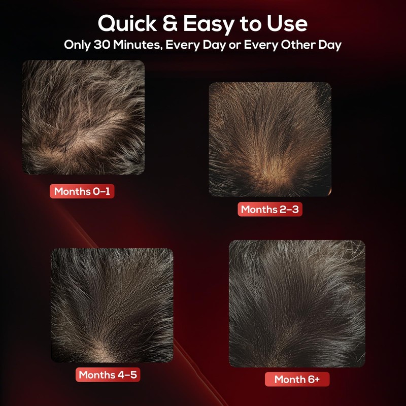 Laser Hair Growth Cap, Low Level Laser Therapy (LLLT) Device