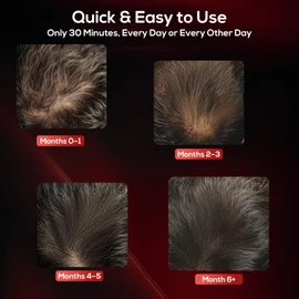 Laser Hair Growth Cap, Low Level Laser Therapy (LLLT) Device Designed to Promote Hair Growth in Women and Men,Laser Cap