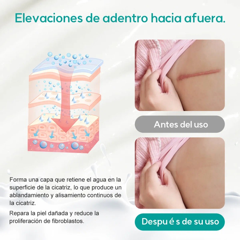 Crema Para Eliminar Cicatrices Para Reparar Cicatrices 1pc
