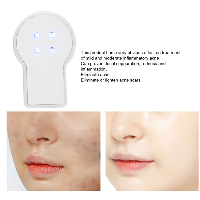 USB Plug In Mini Handheld Acne Removal Machine Blue Light