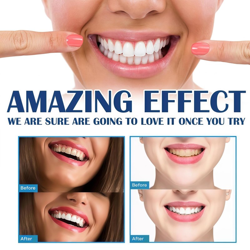 2PCS Teeth Whitening Paints,Tooth Polishing Paste,Whitening Toothpaste,Instant & Long-Lasting Results,Dual