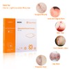Hydrocolloid Bandage, Hydrocolloid Wound Dressing Thin Type 4'' x 4''