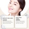 Anti-Wrinkle Patches for Lips, Elastic Anti-Wrinkle Band, Lip Balm, for