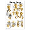 Hip and Knee Anatomical Poster, size 24Wx36T