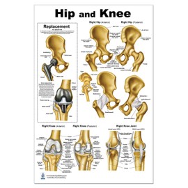 Hip and Knee Anatomical Poster, size 24Wx36T