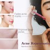 AHA 30% + BHA 2% Peeling Solution, Chemical Peel for