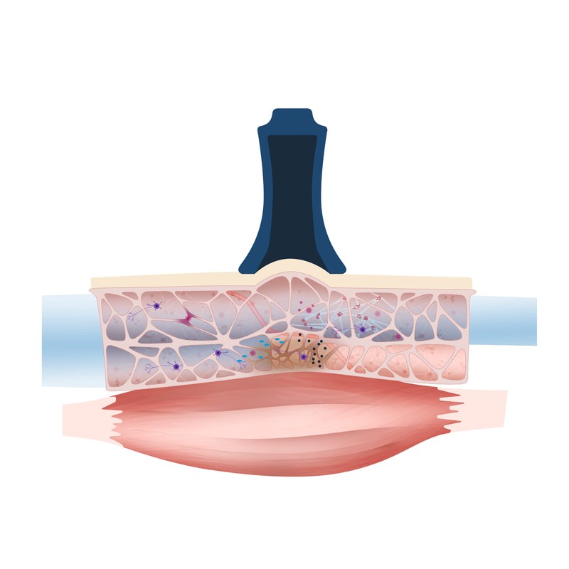 BellaBambi Mini trio: Sensitive, Regular, Intense (White, Blackberry, Midnight Blue),